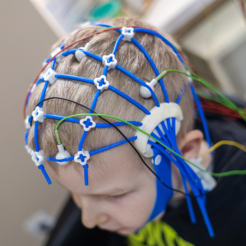 électroencéphalogramme (EEG) électroencéphalogramme (EEG)
